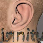 tinnitus